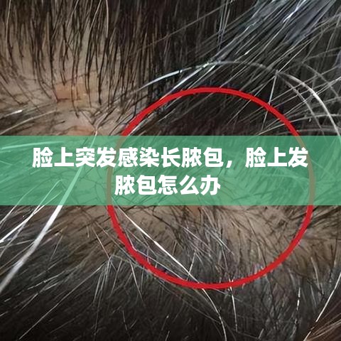 臉上突發(fā)感染長(zhǎng)膿包，臉上發(fā)膿包怎么辦