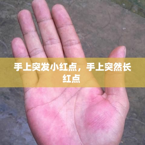 手上突發(fā)小紅點，手上突然長紅點